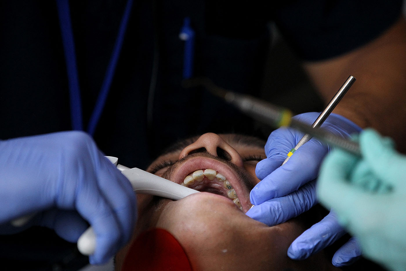Materiales naturales ayudarían a resolver el problema de la odontología en torno a la adhesión y el uso del ácido fluorhídrico, que puede ser peligroso. Foto: Justin Sullivan - Getty Images North America Getty Images via AFP.