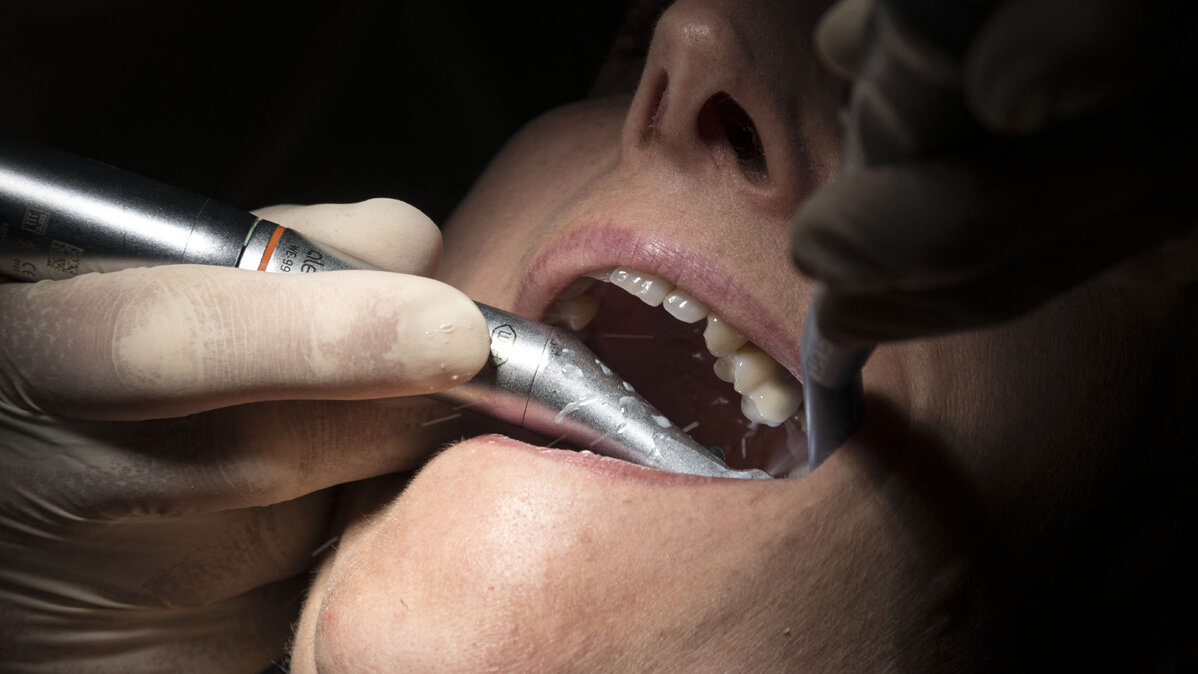 La encía es el tejido blando que está alrededor de los dientes, cuando este se pierde se producen alteraciones como sensibilidad dental, cúmulo de comida e infecciones. SEBASTIEN BOZON / AFP