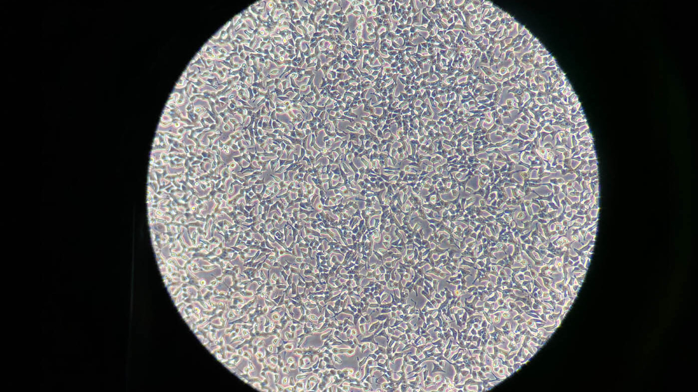 Línea celular INS-1 de insulinoma de murinos visualizada a través de microscopio de luz. Foto: Nathalia Montoya Oviedo, médica cirujana de la UNAL.