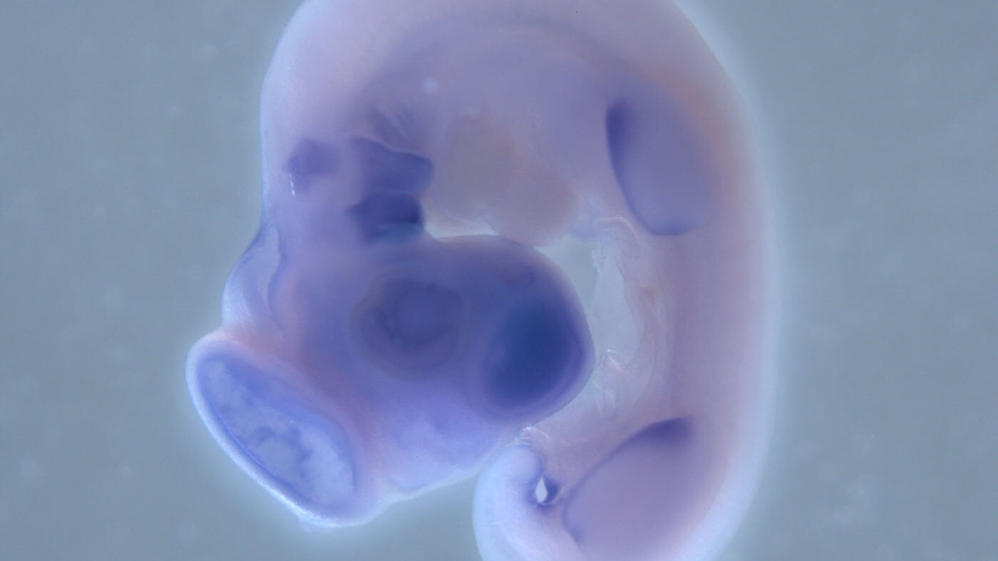 El método de RNA interferencia es una técnica novedosa evaluada en embriones de pollo que analiza las funciones genéticas asociadas con malformaciones de la mandíbula. Fotos: Joan Sebastián Joya, estudiante de la maestría en Ciencias con énfasis en Biología de la UNAL