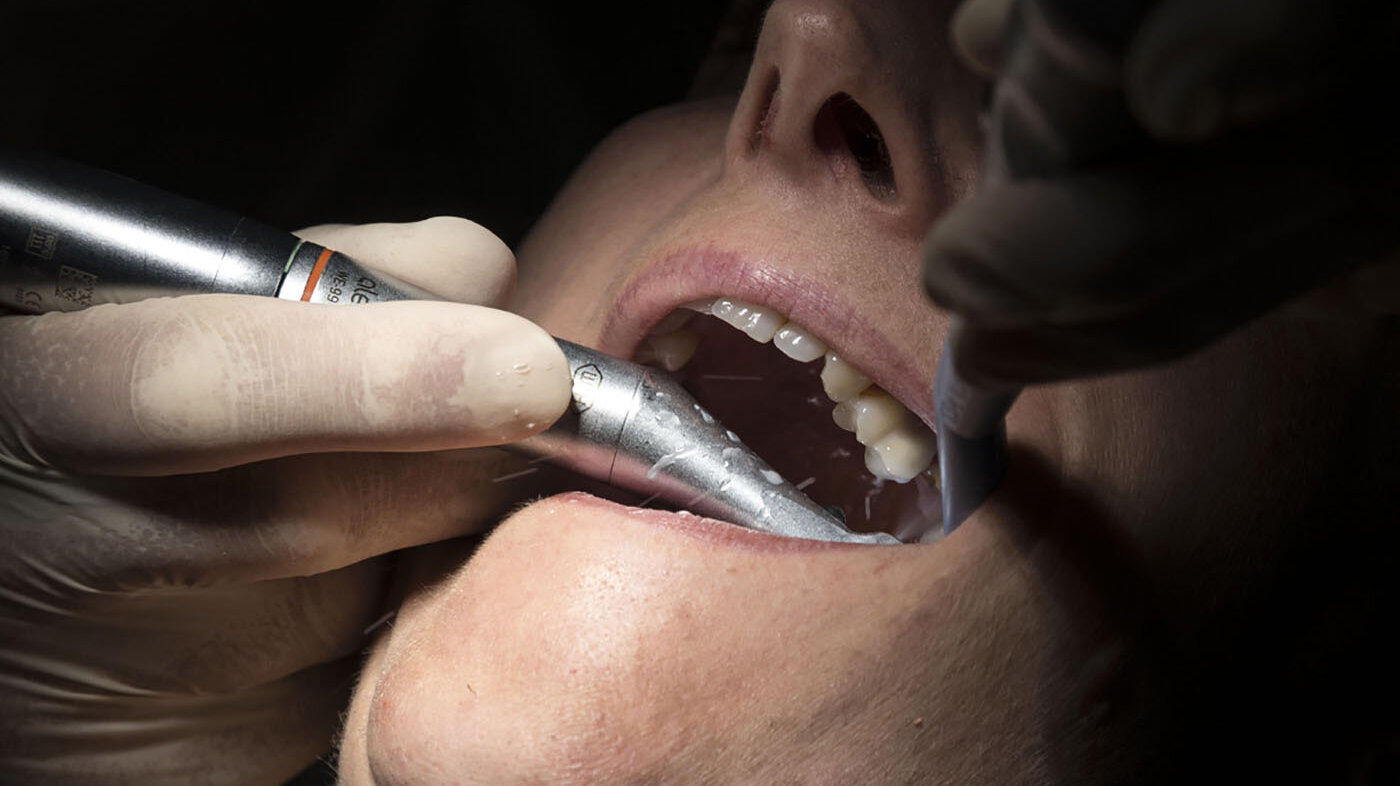 La decoloración de los dientes, ya sea con tonalidades oscuras u opacas, son condiciones asociadas con este problema dental. Foto: Sebastien Bozon / AFP.