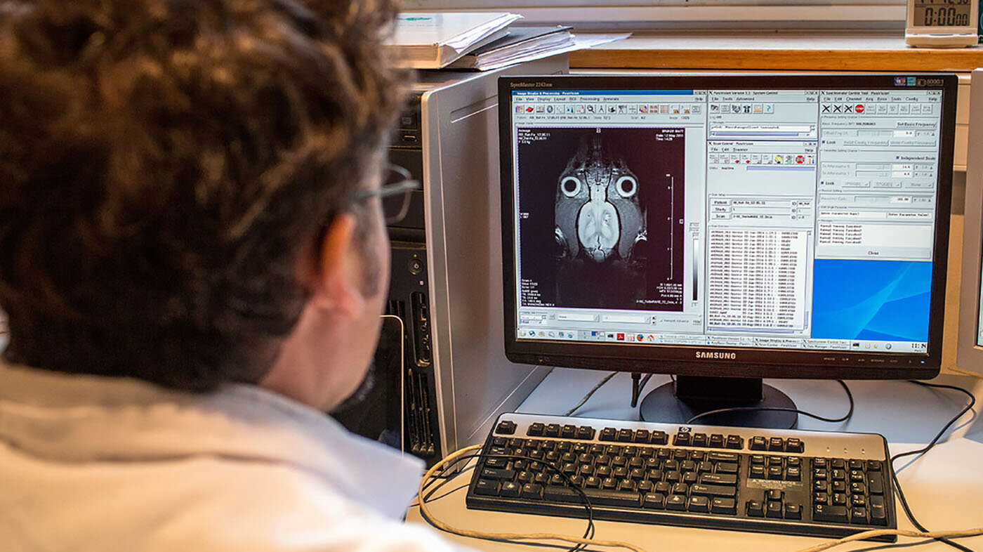 La investigación doctoral desarrolla la conexión cerebro-computador, la cual forma parte de la neuroingeniería. Foto: Philippe Merle / AFP.