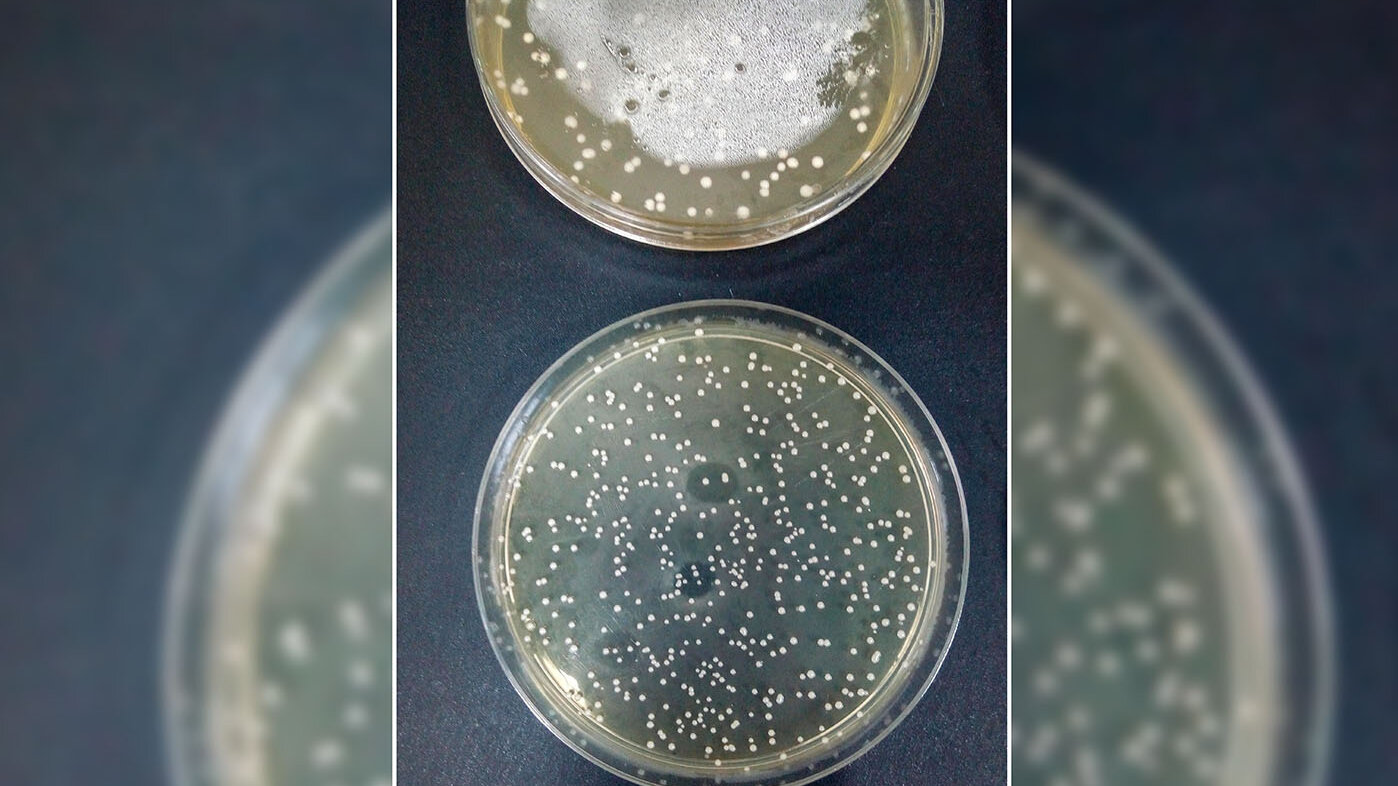 Crecimiento en placa de Petri de Lactobacillus plantarum. Fotos: Catalina Fajardo Argoti, magíster en Ciencias Agrarias de la UNAL Sede Medellín.