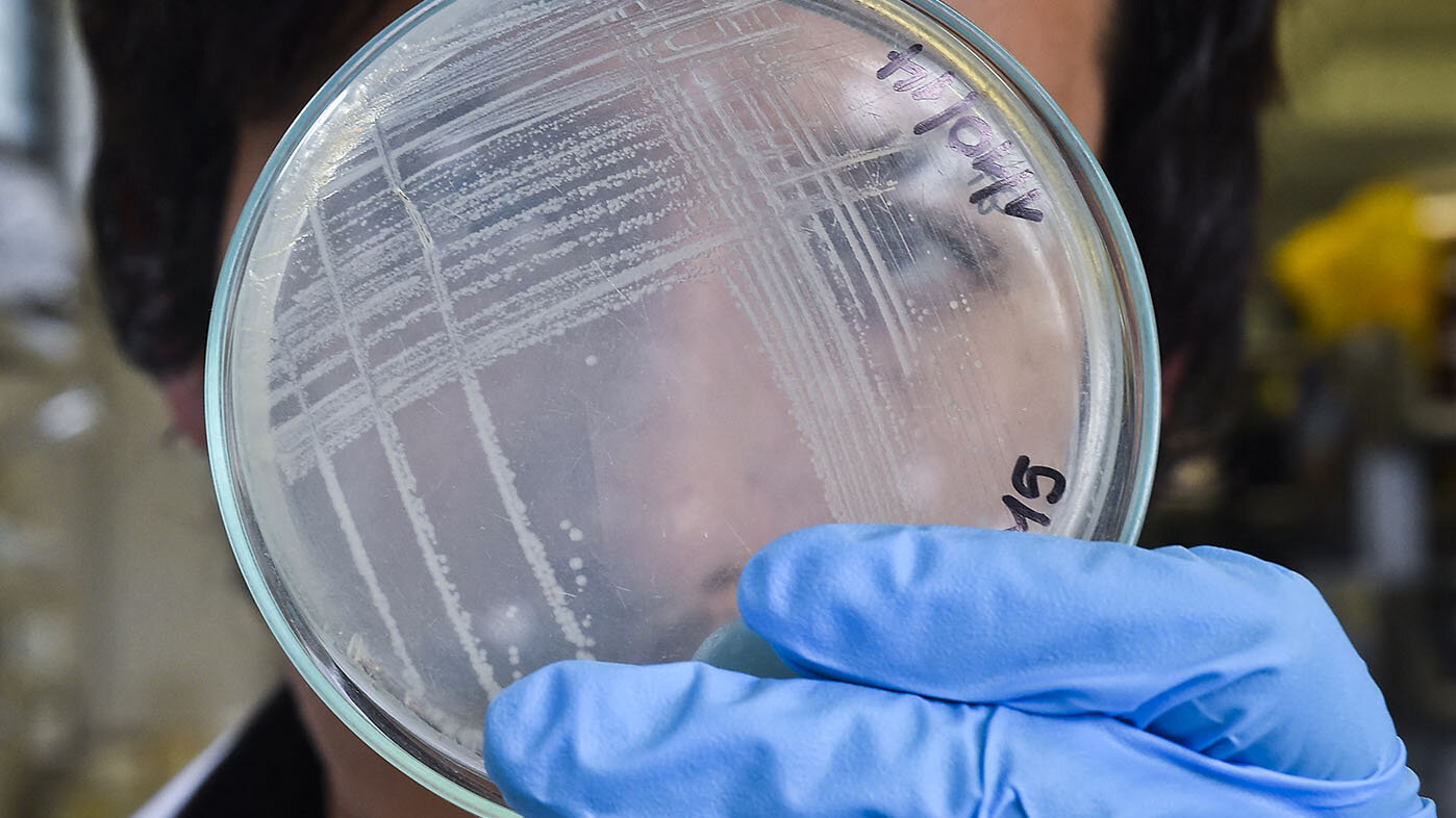 Aunque los antibióticos salvan miles de vida en el mundo, las bacterias que estos atacan se hacen cada vez más resistentes. Foto: Luis Acosta - AFP.
