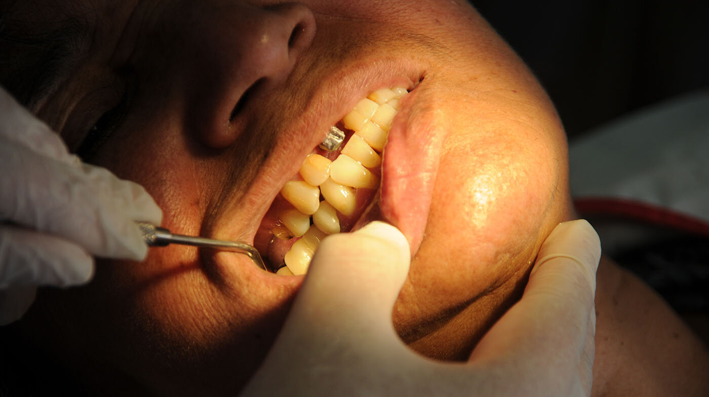 El dolor dental se disminuiría con estudios de laboratorio que encuentren la manera de bloquear el paso de sustancias que afectan los nervios. Foto: archivo Unimedios.