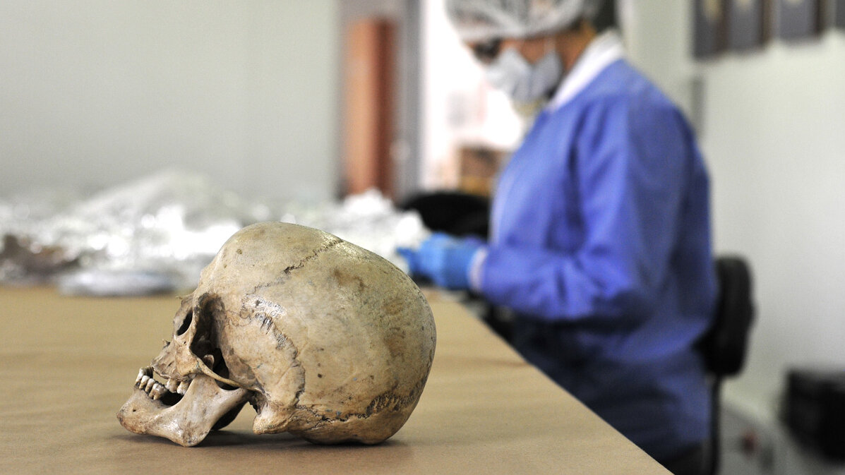 Tradicionalmente, desde la fisiopatología se creía que el grosor del cráneo disminuía con la edad. Fotos: Unimedios