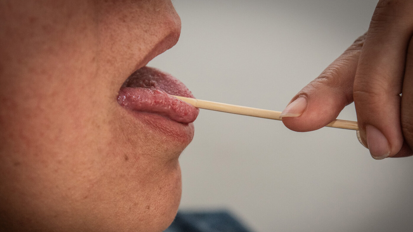 Con análisis de tumores en 3D se mejoraría a futuro el tratamiento contra el cáncer de lengua. Foto: María Fernanda Londoño, Unimedios.