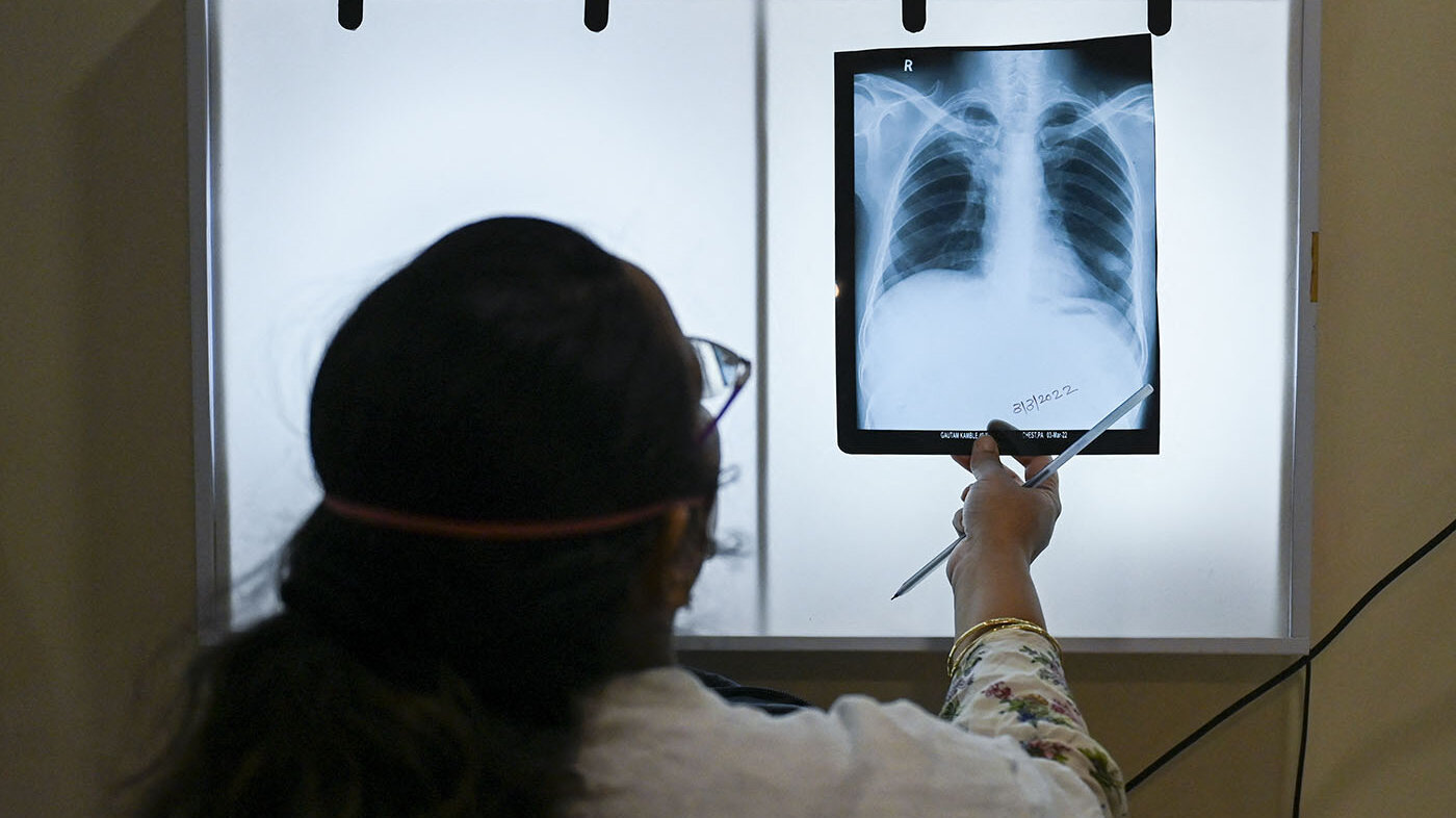 La Maestría en Física Médica de la UNAL es un programa pionero en Colombia. Foto: Punit Paranjpe / AFP.