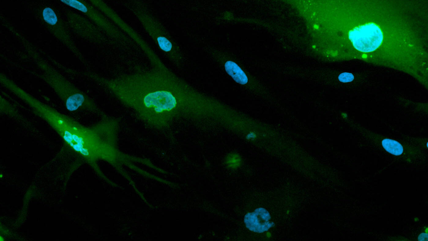 Se observa la producción de la proteína de la inflamación (verde) en las células de las encías (núcleos azules) infectadas con citomegalovirus. Foto: Sara Delgadillo, odontóloga UNAL.