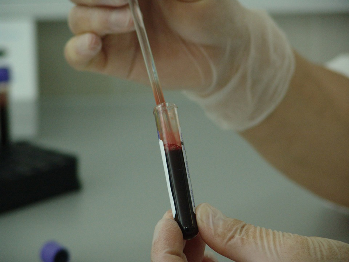 Los dos tipos de pruebas más comunes son la serológica (por medio de muestra de sangre) y la molecular. Fotos: archivo Unimedios.