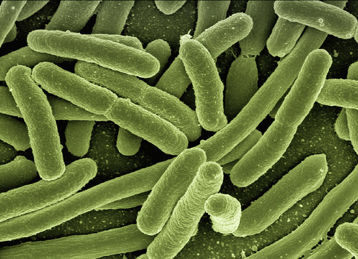 Aunque por lo general E. coli se relaciona con infecciones del tracto intestinal, también se emplea en la industria química o farmacéutica. Foto: Creative Commons