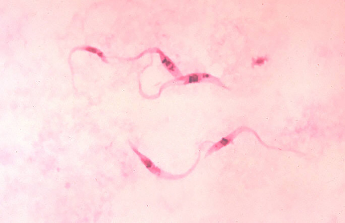 El parasito intracelular Trypanosoma cruzi es el causante de la enfermedad de Chagas. Fotos: archivo Unimedios