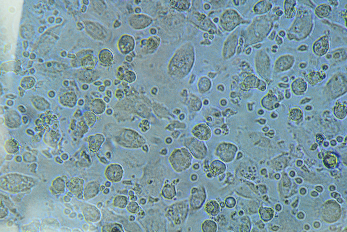 La leishmaniasis es una enfermedad infecciosa causada por protozoos del género Leishmania. Fotos: archivo Unimedios.